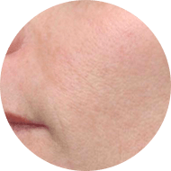 after image