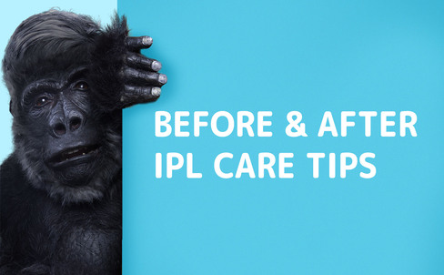 Tips to care for your skin before and after IPL treatment