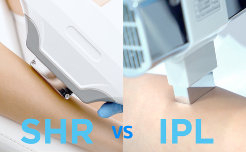 IPL VS SHR