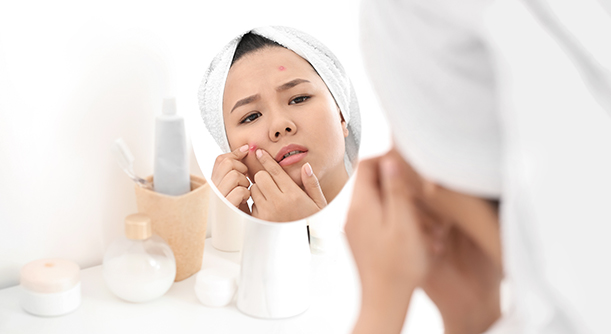 (Part 2) How can you tell if IPL Skin Solution is working for you?