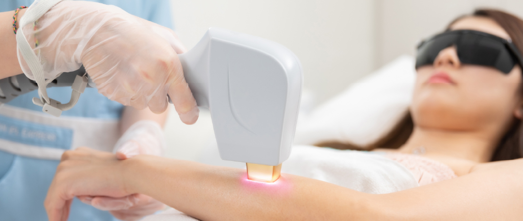 (Part 1) How can you tell if IPL Hair Removal is working for you?